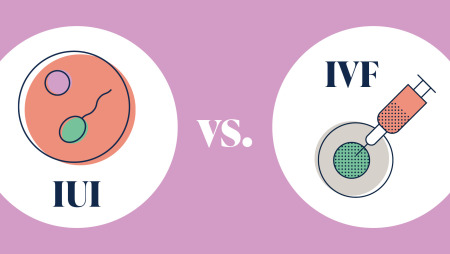 What is the Difference Between IUI and IVF?