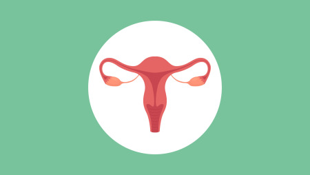 PCOS FAQ